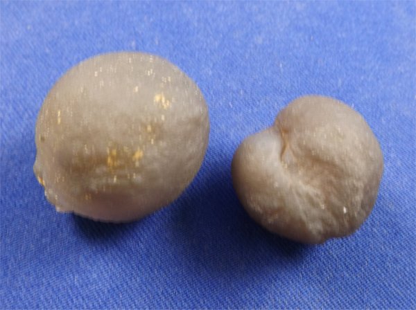 Botryoidal Chalcedony Large