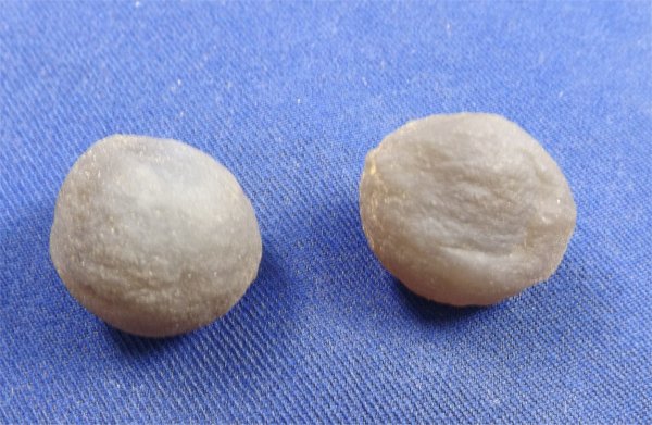 Botryoidal Chalcedony Small